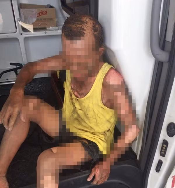 Bo dang an com bi con do xang cham lua dot