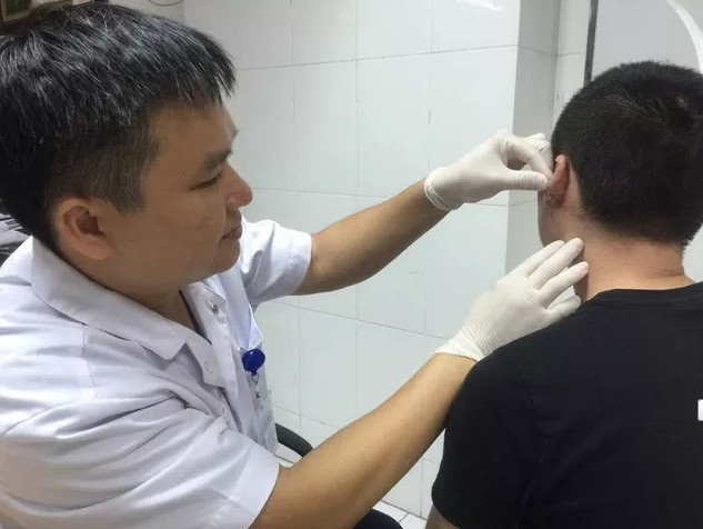 Nam sinh bien dang “tai sup lo” vi thich deo khuyen cho 