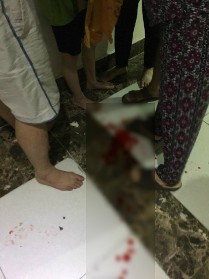 Đáng nói, có nhiều trường hợp vật rơi là do xuất phát từ chính các công trình xây dựng. Điển hình như vụ gạch men ốp tường đã rơi trúng vào nhóm trẻ em đang chơi tại tại chung cư Tân Tây Đô, Tân Lập, Đan Phượng, TP.Hà Nội hồi tháng 5/2018. Ảnh: Moitruongvadothi.