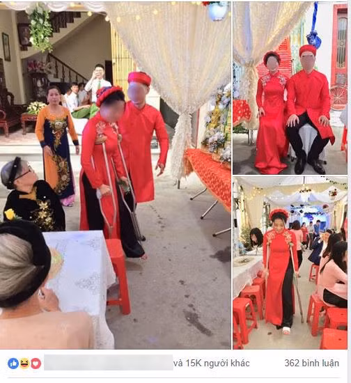 Co dau so nho bi nga gay chan ngay truoc ngay cuoi