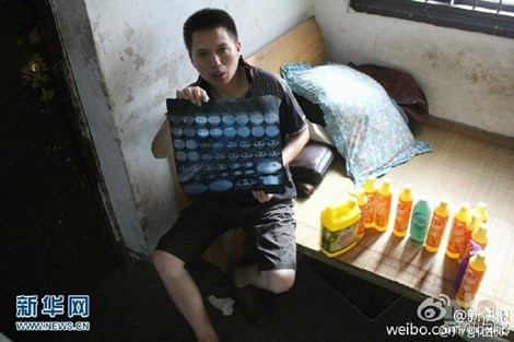 Các bác sỹ cho biết, tình trạng này thường xảy ra ở phụ nữ mang thai và trẻ em, chứ với một người đàn ông thì quả là hiếm. Tuy nó không nguy hiểm, nhưng nếu uống nhiều thì chất hóa học trong chất tẩy rửa sẽ gây ra hậu quả khôn lường.