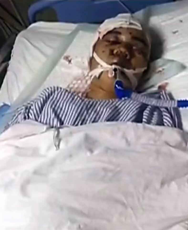 Tại bệnh viện, các bác sỹ chụp X-Quang và phát hiện 80 viên đạn chì trong đầu nạn nhân. Các bác sỹ đã lên kế hoạch phẫu thuật khẩn cấp để gắp đạn ra ngoài. Hiện, anh Công vẫn chưa tỉnh lại và đang trong tình trạng nguy kịch cần theo dõi.