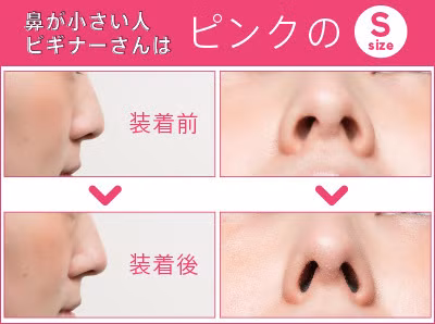 Sản phẩm mũi cao không dao kéo này không chỉ làm cánh mũi gọn gàng hơn, cao hơn mà nó sẽ tạo hình hơi nhọn, hình ảnh thường thấy của các nhân vật trong manga và amine. 