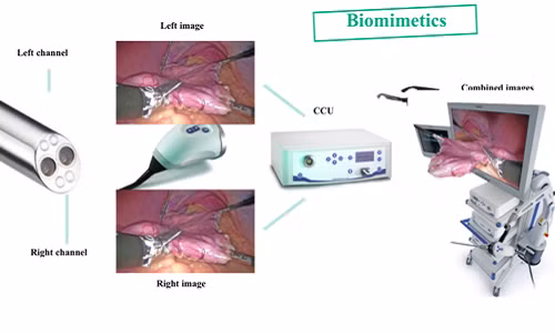 Phẫu thuật nội soi 3D lần đầu tiên tại Việt Nam.