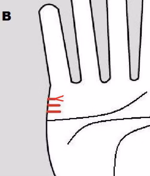 Bàn tay có nhiều hơn hai đường hôn nhân chứng tỏ chủ nhân trắc trắc đường tình duyên. Những trở ngại trong tình yêu xuất phát từ sự can thiệp của người thứ ba. Ảnh: Chinesehoroscop. (Bài viết chỉ mang tính chất tham khảo, cung cấp nội dung mang tính trắc nghiệm vui cho bạn đọc).