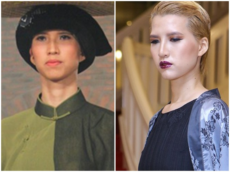 Năm 2016, người mẫu Hồng Xuân vắng bóng trong các sự kiện vì dao kéo để thay đổi diện mạo. Cô nhấn mí, độn cằm, nâng mũi, thay răng. Ảnh: Vietnam’s Next Top Model, Zing