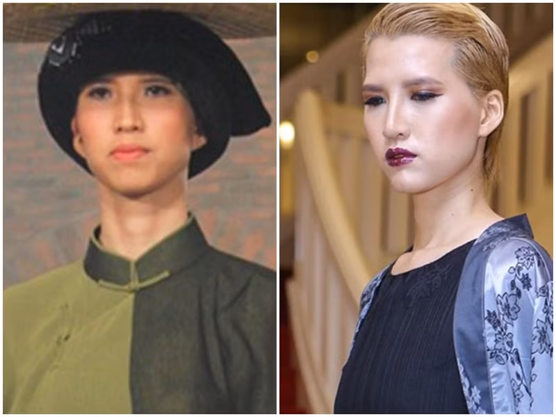 Năm 2016, người mẫu Hồng Xuân vắng bóng trong các sự kiện vì dao kéo để thay đổi diện mạo. Cô nhấn mí, độn cằm, nâng mũi, thay răng. Ảnh: Vietnam’s Next Top Model, Zing