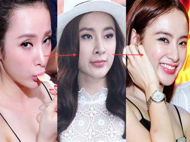 "Bà mẹ nhí" bị nghi chịu biến chứng phẫu thẩm mỹ. Ảnh: Sức khỏe và đời sống