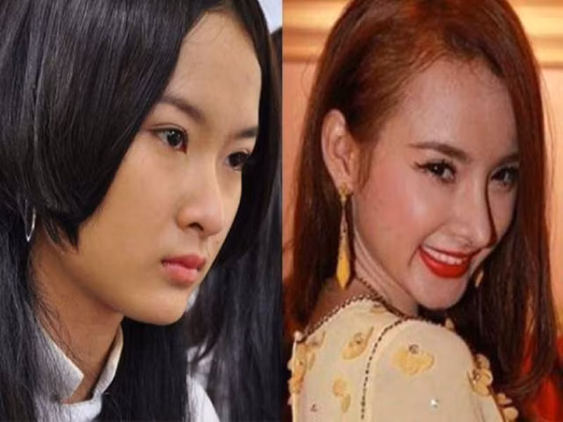  Angela Phương Trinh sở hữu gương mặt xinh xắn nhưng vẫn cho rằng mũi của cô chưa thật đẹp vì cánh mũi hơi to. Thế nên “bà mẹ nhí” chi 35 triệu để nâng và thu hẹp cánh mũi. Tuy nhiên, sau khi chỉnh sửa mũi, Angela Phương Trinh thường xuyên gặp rắc rối với chiếc mũi có lúc bị gồ lên hay cánh mũi bị lệch. Ảnh: Sức khỏe và đời sống