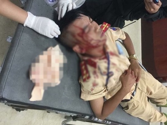 Ly lich bat hao doi tuong cam da danh dai uy CSGT nhap vien