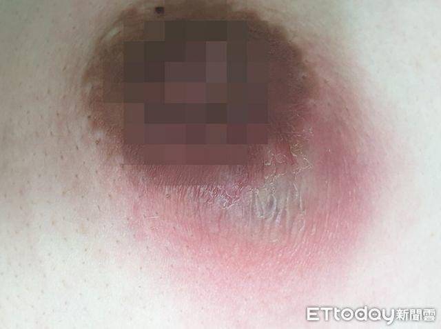 Vi thoi quen cua trieu ong chong, nguoi phu nu khong cho con bu bi viem vu