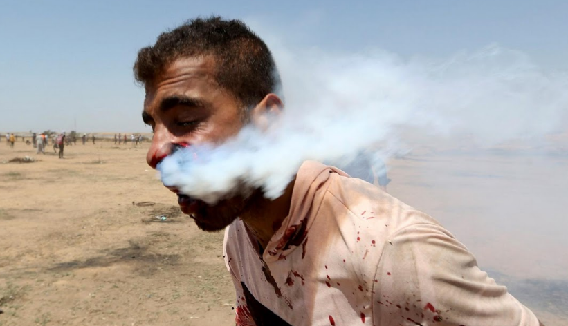 Haitham Abu Sabla, 23 tuổi, bị thương trong cuộc đụng độ với lực lượng an ninh Israel tại khu vực biên giới Gaza-Israel.