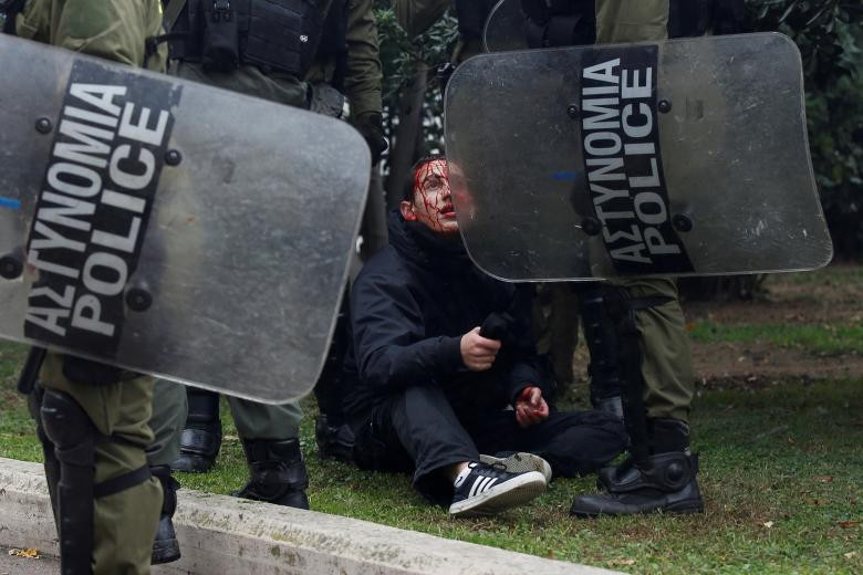 Một người biểu tình bị thương bị cảnh sát Hy Lạp bắt giữ ở Athens.