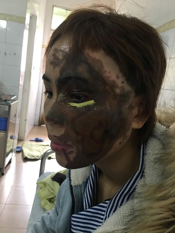 Sợ hãi trước sự thay đổi của chồng sắp cưới, Vy muốn hủy hôn nhưng Hải không đồng ý. Hai người thường xảy ra tranh cãi. Hải hứa sẽ thay đổi nhưng Vy quyết tâm dừng lại.