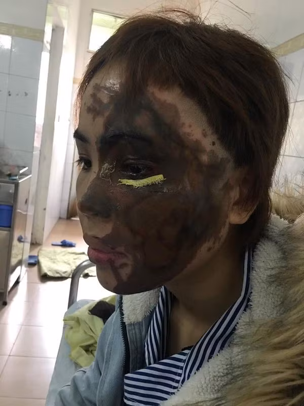 Sợ hãi trước sự thay đổi của chồng sắp cưới, Vy muốn hủy hôn nhưng Hải không đồng ý. Hai người thường xảy ra tranh cãi. Hải hứa sẽ thay đổi nhưng Vy quyết tâm dừng lại.