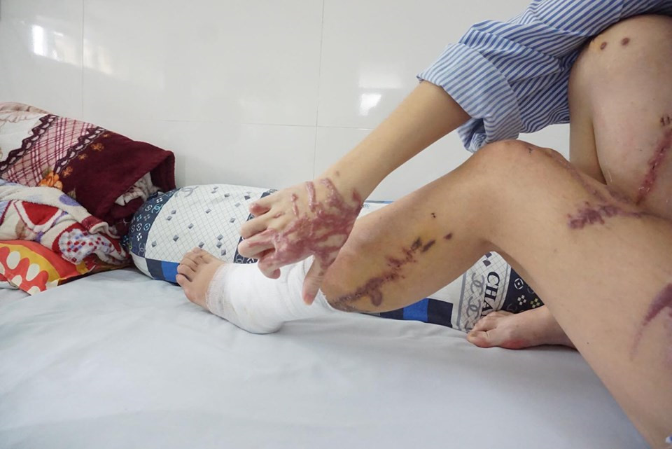 Chị Dung cho biết theo quy định của công ty, khi khách hàng lẻ đến hỏi mua hàng hóa, chị phải tư vấn chi tiết cho khách. “Từ khi tôi vào làm thì cứ có khách mua là bán chứ không quy định là không bán cho khách lẻ. Chỉ không được bán lẻ hóa chất được chiết từ can to ra” - chị Dung chia sẻ.