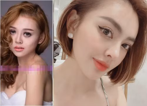Trước đó trên MXH xuất hiện một số hình ảnh được cho là Trang Nemo thời chưa trùng tu với hàm răng khấp khểnh, sống mũi thấp tẹt,... được netizen truyền tay nhau rầm rộ, từng gây xôn xao.