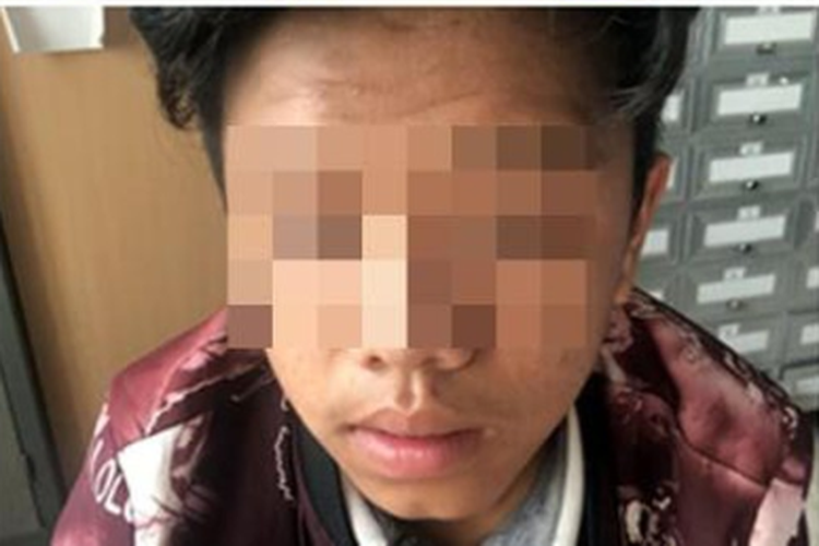 Sau khi lấy dây buộc tóc, hai em L. và T. về nhà cất xe máy rồi đi bộ xuống cầu Bộ Đội (thôn Trung Hạ, xã Quế Trung) thì lại gặp bốn thanh niên trên đi 3 xe máy rủ đi dạo, khi đến khu vực đường bê tông thuộc thôn Phước Bình, xã Sơn Viên thì cả nhóm dừng xe. (Nam thanh niên liên quan đến vụ việc. Ảnh: CA)