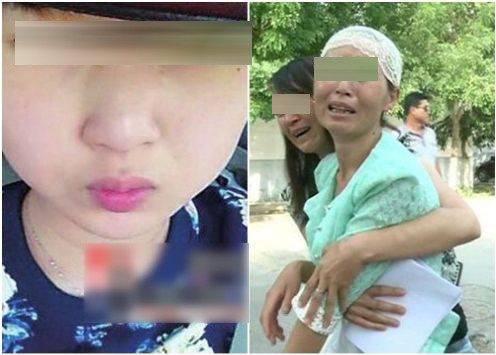 Tháng 7/2014, một nạn nhân nữ người Trung Quốc được phát hiện chết trên giường với những vết bỏng trên cơ thể, chiếc điện thoại đang cắm sạc để ở bên cổ nạn nhân đã bị nổ vỡ màn hình, nút bấm hai bên bị cháy đen. Báo cáo kết luận rằng nạn nhân đã bị tử vong do điện giật. Đây không phải trường hợp lần đầu người dùng iPhone gặp tai nạn.