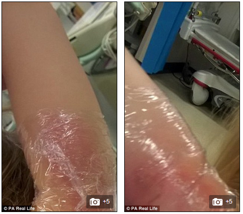 Sau 8 ngày điều trị, Bella Davey-Lawrence được ra viện. Gia đình Bella thiết lập một quỹ quyên góp mang tên Go Fund Me để cảm ơn bệnh viện đã điều trị cho con gái mình.