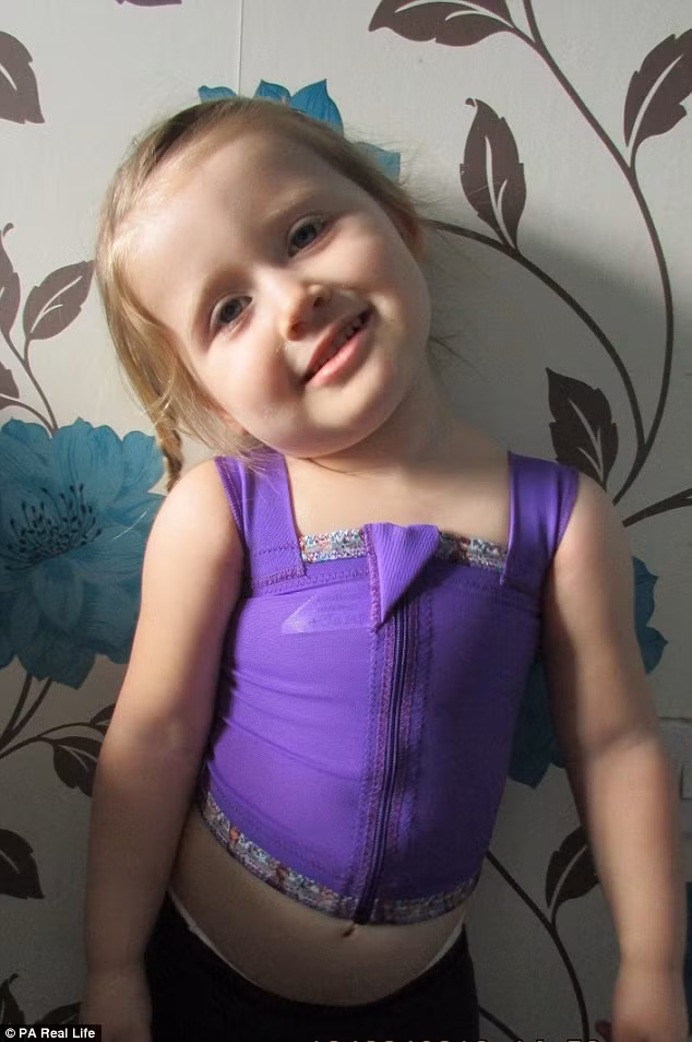 Mẹ của bé Bella Davey-Lawrence vừa công bố một hình ảnh gây sốc về vết thương trải rộng khắp lưng và cánh tay cô bé do bỏng độ 2 khi chơi với bộ tản nhiệt. 