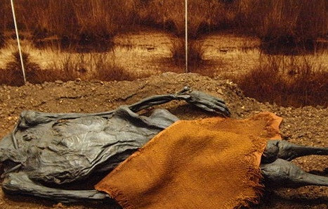 Cú đánh mạnh trên để lại một lỗ hổng hình tam giác trên hộp sọ của xác ướp Rendswühren.