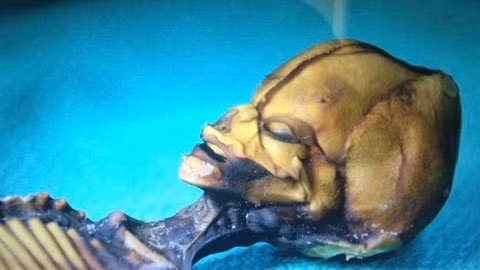 Kết quả nghiên cứu cũng cho thấy bộ xương Ata có niên đại không quá 40 năm. Với kết quả nghiên cứu này, các chuyên gia đã bác bỏ giả thuyết Ata là hài cốt người ngoài hành tinh. Video: Thụy Sĩ mở lớp dạy ngôn ngữ của người ngoài hành tinh (nguồn: VTC14)