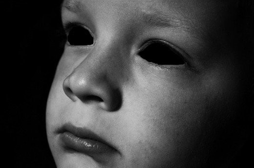 Nhận thấy câu chuyện có phần kỳ lạ và bí ẩn nên ông Bethel cẩn thận suy nghĩ và nhìn kỹ gương mặt hai cậu bé thì phát hiện sự thật khó tin. Đó là đôi mắt của hai bé trai chỉ có con người đen sì mà không có đồng tử.