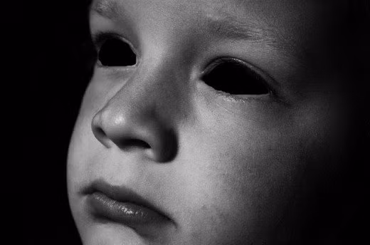 Nhận thấy câu chuyện có phần kỳ lạ và bí ẩn nên ông Bethel cẩn thận suy nghĩ và nhìn kỹ gương mặt hai cậu bé thì phát hiện sự thật khó tin. Đó là đôi mắt của hai bé trai chỉ có con người đen sì mà không có đồng tử.