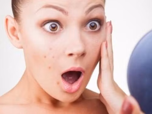 Dị ứng đu đủ thường có các triệu chứng sau: sưng miệng, ngứa xung quanh mặt và cổ họng, phát ban trên lưỡi, chóng mặt, nhức đầu, đau bụng, khó thở và khó nuốt.