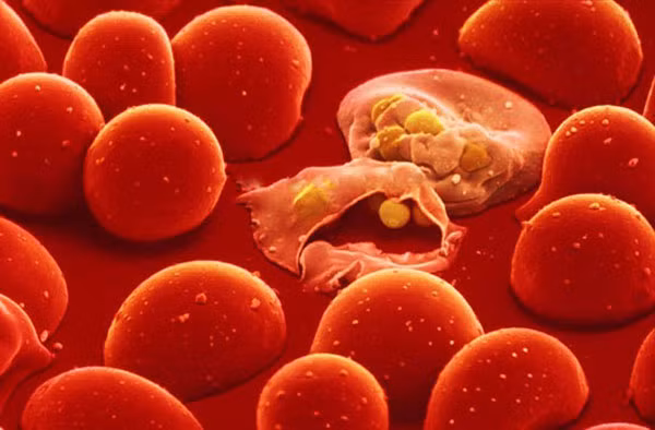 Những người bị bệnh loãng máu. Những người bị bệnh loãng máu nên tránh ăn đu đủ vì lá đu đủ có khả năng làm loãng máu. Do đó nếu bạn đang dùng bất kỳ loại thuốc nào để chữa bệnh loãng máu hoặc thuốc chống đông máu như aspirin chẳng hạn, hoặc bạn vừa trải qua một ca phẫu thuật cách đây vài tuần, hãy tránh xa loại quả này do tính chống đông máu của nó.