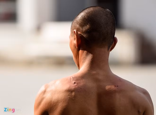 Phần lưng của võ sư Tuấn không chảy máu.