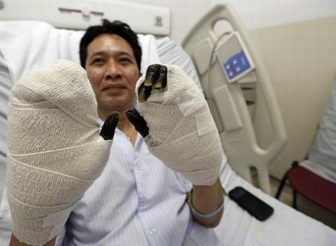 Khủng khiép chan tay thói rũa den sì do an ca song