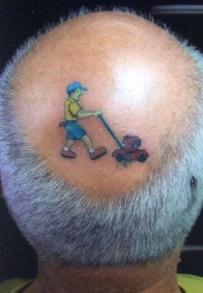 Nguyên nhân bị hói đầu là bởi máy cắt cỏ.