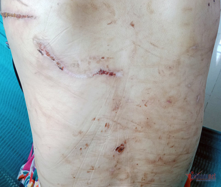 Thai phu bi bao hanh co can tro ve Hai Duong phuc vu dieu tra?-Hinh-3