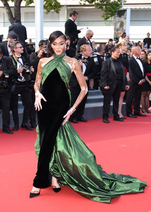Người mẫu bạch biến Winnie Harlow cũng dự thảm đỏ Cannes. Ảnh: Harper's Bazaar.