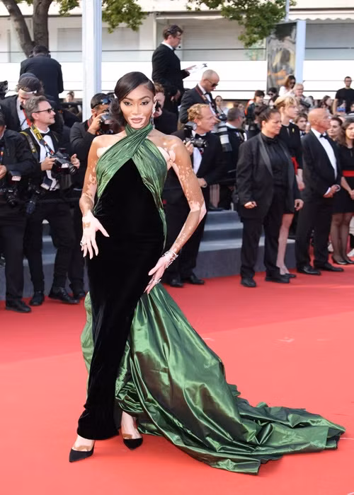 Người mẫu bạch biến Winnie Harlow cũng dự thảm đỏ Cannes. Ảnh: Harper's Bazaar.