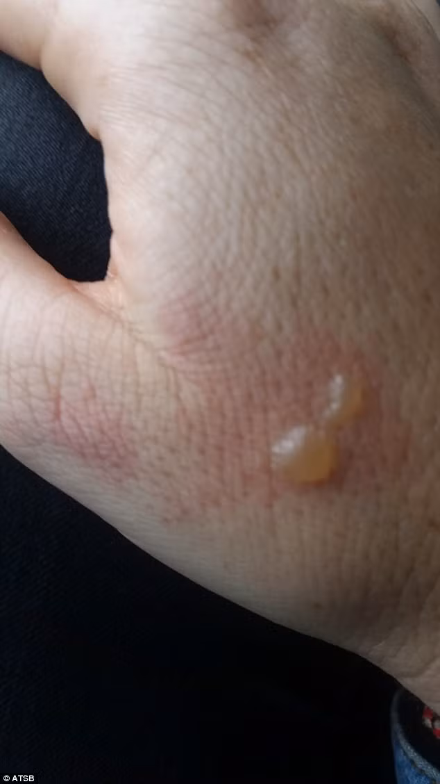 Cục an toàn vận tải của Australia quy định các thiết bị chạy bằng pin khi không sử dụng cần để ở ngăn chứa cho phép. Pin dự phòng nên để trong hành lý xách tay và khi cần lấy, hành khách có thể nhờ tiếp viên tìm để không phải rời khỏi chỗ ngồi. Đơn vị này cho biết đây không phải là lần đầu tiên các thiết bị điện tử có pin lithium phát nổ.