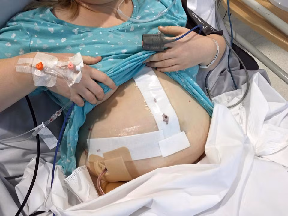 Mặc dù xác định đây không phải là ung thư nhưng xét nghiệm kỹ hơn cho thấy đây là khối tăng sản trung tâm – tức một khối u lành do dùng thuốc tránh thai trong thời gian dài. 