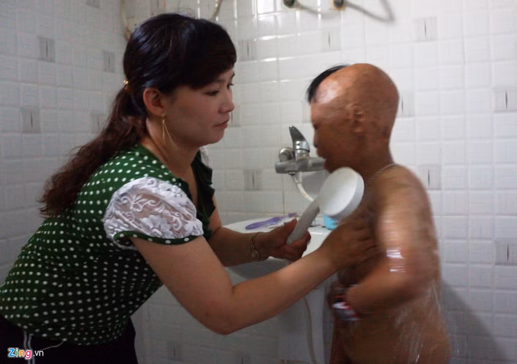 Linh có thể tự sinh hoạt cá nhân như đánh răng, chải đầu. Nhưng việc tắm rửa cậu bé phải có sự trợ giúp của mẹ vì ngón tay không linh hoạt như người bình thường.