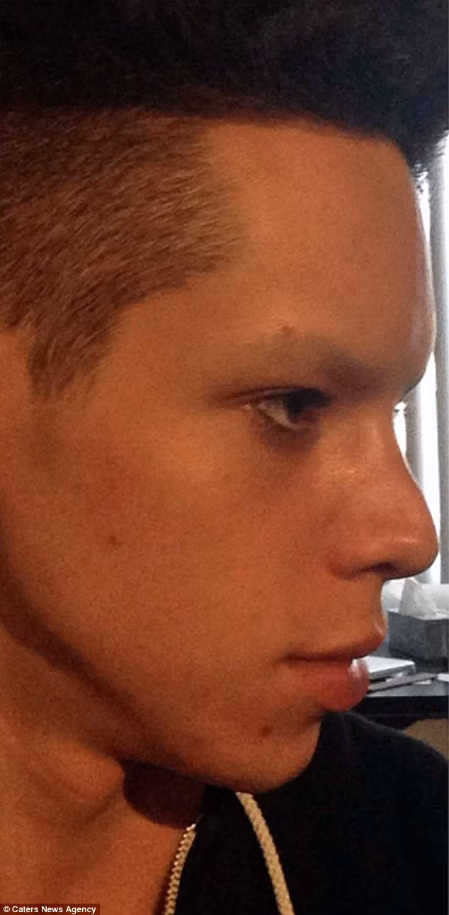 Quá trình thẩm mỹ của Vinny Ohh băt đầu từ năm 17 tuổi, đầu tiên là bơm môi, sau đó đến 2 lần sửa mũi, nhiều lần sửa cằm, tiêm chất làm đầy vào khuôn lông mày…Ngoài ra người mẫu bán thời gian này còn thường xuyên đeo kính áp tròng màu đen, để móng tay như người ngoài hành tinh và nhuộm những màu tóc lạ. Đây là hình ảnh Vinny trước khi phẫu thuật thẩm mỹ. 