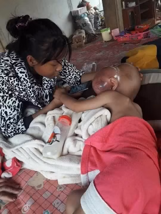 Mặc dù khối u sưng to lên trên đầu nhưng gia đình bé cương quyết không phẫu thuật can thiệp vì họ hy vọng các chuyên gia sẽ tìm ra phương pháp cứu chữa nào ít khắc nghiệt hơn. 