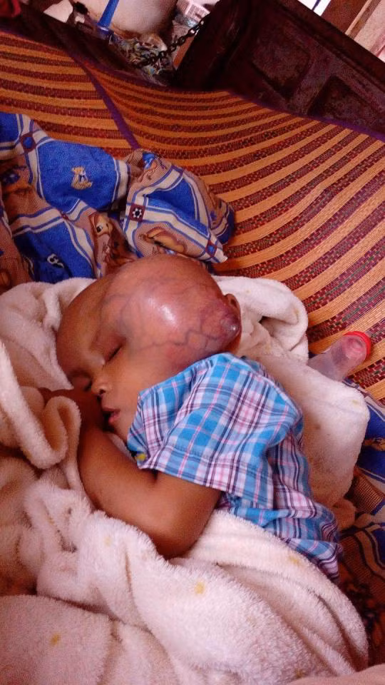 Đây là những hình ảnh gây sốc về một em bé phải chống chọi với bệnh ung thư. Bé trai mới 23 tháng tuổi này được xác định là bị ung thư cách đây 9 tháng sau khi sinh thiết khối u khổng lồ tại bệnh viện Srinakarin tại Bangkok, Thái Lan.