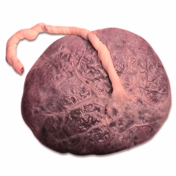 Nhau bà đẻ có lẽ là thứ khó nuốt nhất trong danh sách những nguyên liệu làm đẹp kỳ quái này. Tuy nhiên, người Trung Quốc đã ăn nhau bà đẻ từ cách đây hàng ngàn năm vì cho rằng nhau bà đẻ phơi khô có rất nhiều công dụng như làm sáng da, làm đều màu da, thu nhỏ lỗ chân lông, cải thiện độ ẩm, giảm trứng cá, nếp nhăn và bọng nước.