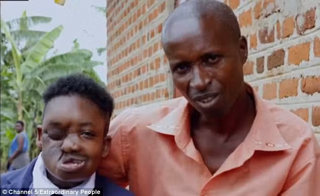 9 tháng sống xa gia đình và trải qua thêm một số lần phẫu thuật khác để tái tạo lại gương mặt. Các bác sĩ đã lấy một mảnh xương sọ của Erick để tái tạo lại phần hàm đã bị khối u ăn mất. Ngoài ra, bác sĩ còn lấy cơ đùi để tạo thành vòm miệng.