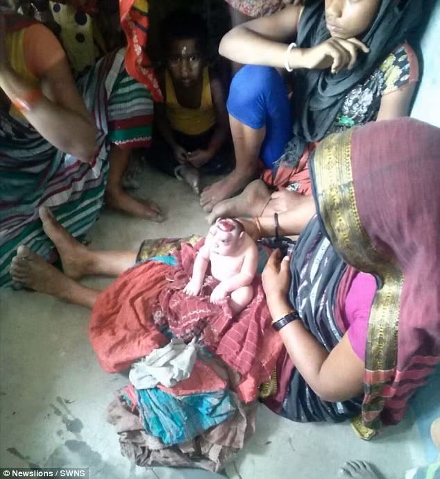 Trẻ sơ sinh mắc dị tật này thường bị khuyết một phần não và xương sọ phía trên, cụ thể là não trước và đại não. Phần não còn lại lại thường không đủ da và xương. 