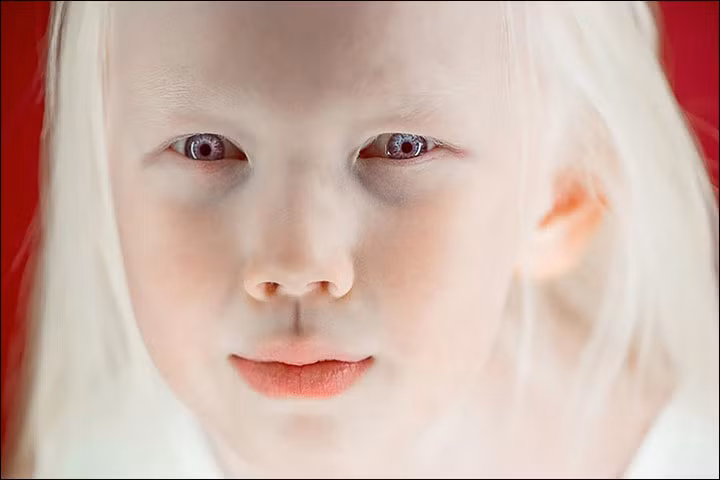 Vẻ đẹp của em bé bạch tạng Nariyana dưới ống kính của nhiếp ảnh gia.