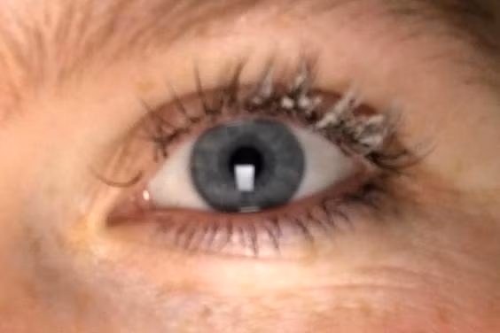 Nếu bạn thấy nóng mắt hoặc khó chịu ở mắt trong khi nối mi khiến bạn chảy nước mắt thì điều này không tốt chút nào. Lúc này bạn nên nói với người nối mi để đổi loại keo khác. 