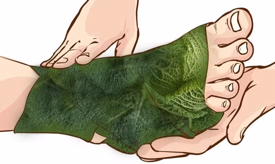 Nhiệt độ cơ thể sẽ làm lá bắp cải ấm lên và trong quá trình đó, một số hợp chất trong lá bắp cải sẽ ngấm vào da. Bài thuốc này được cho là có tác dụng làm tan các tinh thể axit uric gây đau khi bị bệnh gout. Ít nhất thì cách chữa bệnh gout bằng lá bắp cải này cũng có tác dụng làm giảm viêm sưng. 