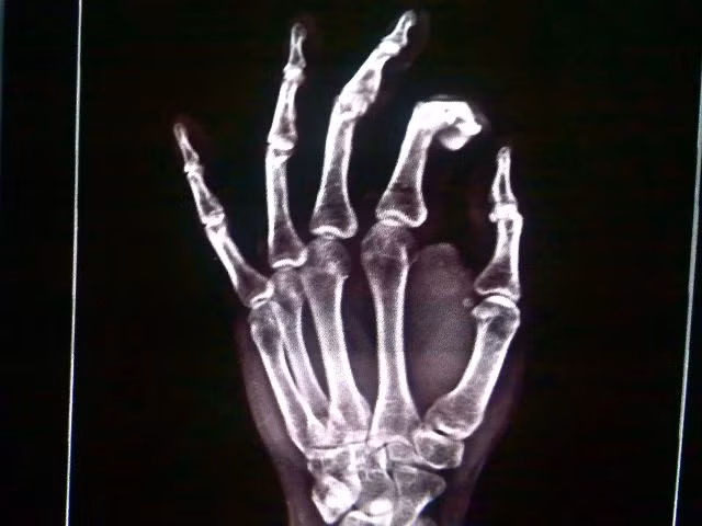 Kỹ thuật viên X-quang: Đây là nghề mà mức độ tiếp xúc với bức xạ rất cao (87%), tiếp xúc với nhiều bệnh tật. 